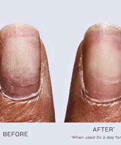 Alternative view of OPI Repair mode