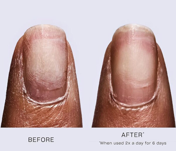 OPI Repair mode – Image 2